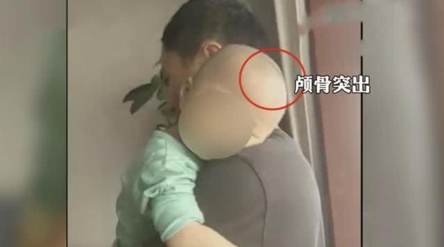 致幼儿喝成大头娃娃 涉事商家注册资本1.5元