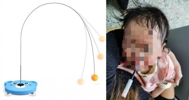 抖音爆红玩具 3岁女童眼睛被扎 大半根深插颅脑